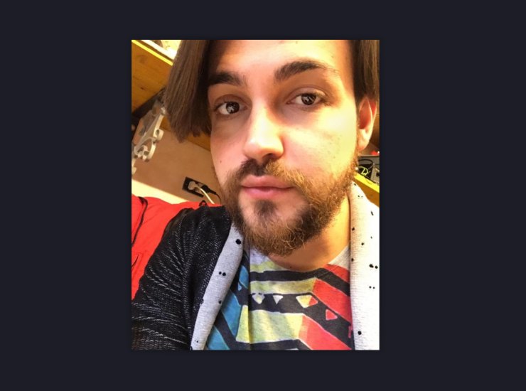 La scottante dichiarazione di Valerio Scanu